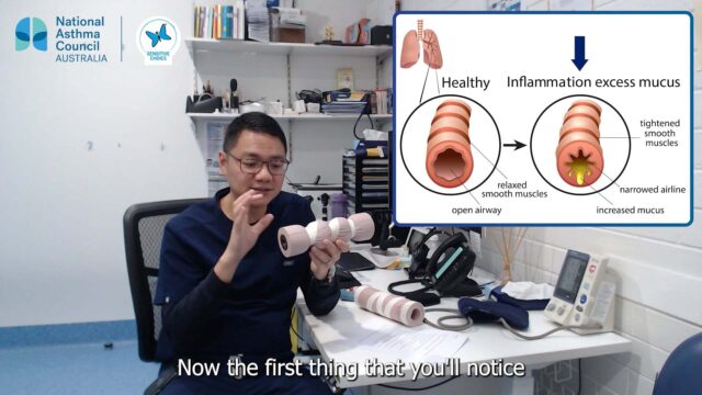 What does asthma look like?